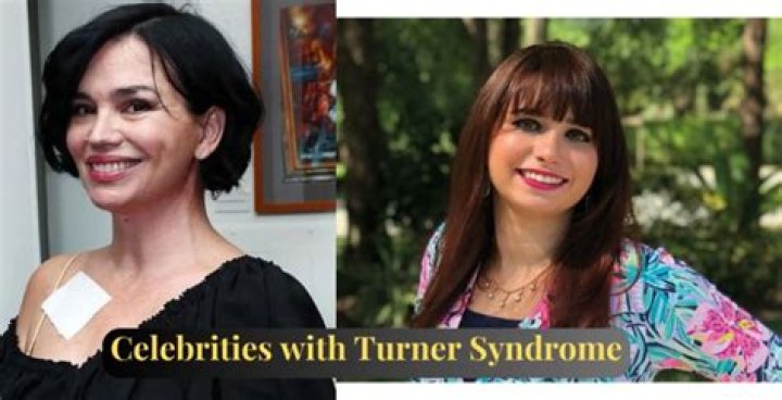 Famous Women With Turner Syndrome: Inspiring Stories