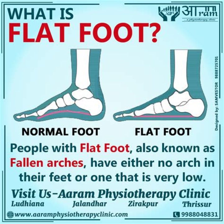 The Enigmatic World Of Flat Foot Singing Meaning