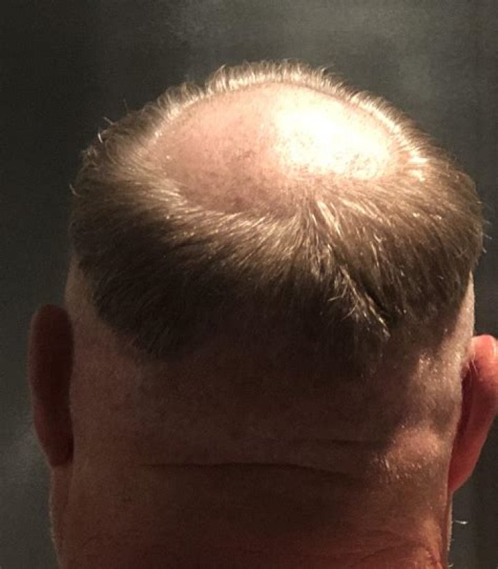Exploring The Unique Charm Of The Friar Tuck Haircut