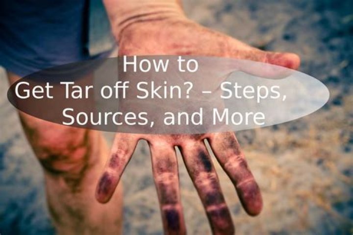Removing Tar: Effective Methods To Get Tar Off Skin