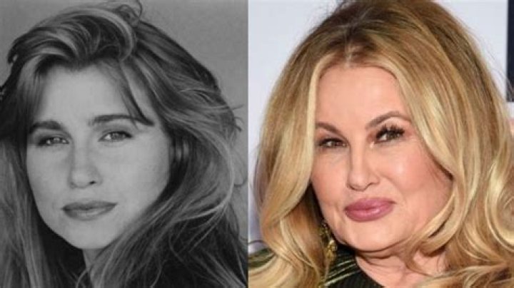 Unveiling The Transformation: Jennifer Coolidge And The Plastic Surgery Debate