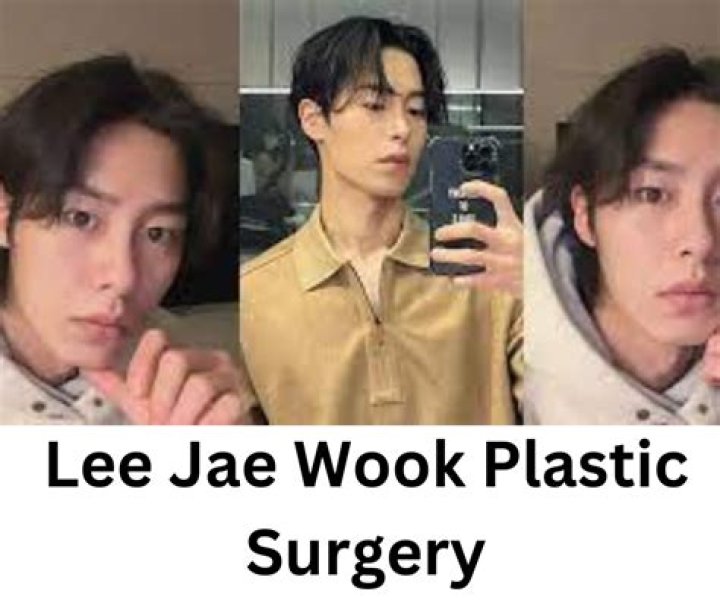 Unveiling The Truth Behind Lee Jae Wook's Plastic Surgery Rumors